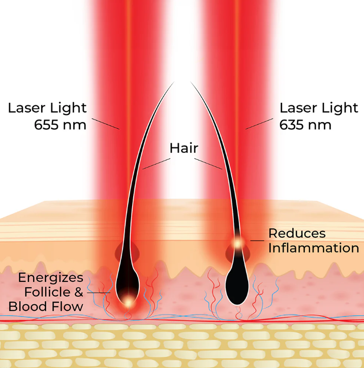 HairMax Actonis™ 18 Dual Action LaserComb