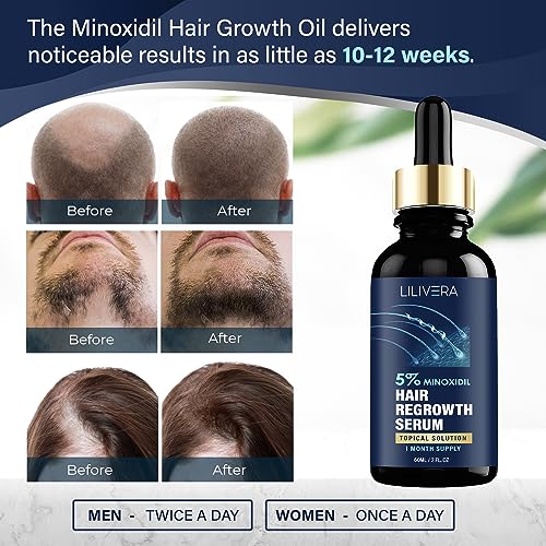 Lilivera 5% Minoxidil for Men and Women Kit, Hair Growth Serum with to ...